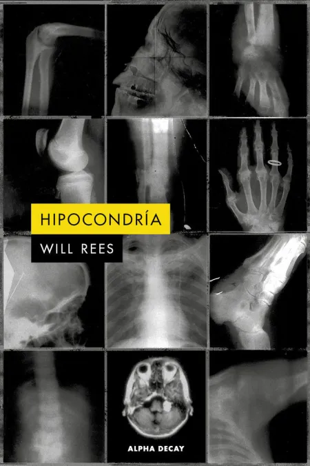 HIPOCONDRIA
